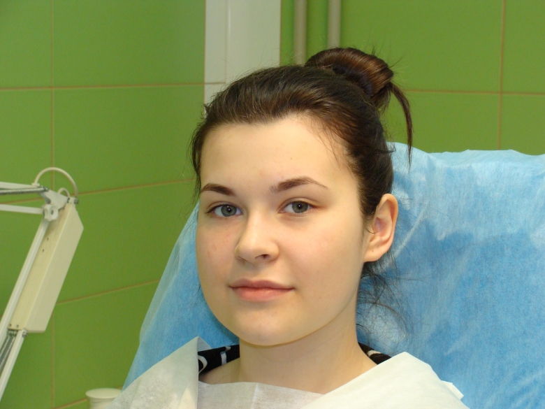 Кожа после процедуры выглядит прекрасно, нет ни покраснения, ни выраженного раздражения.